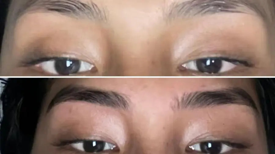 Antes y después de cejas con minoxidil